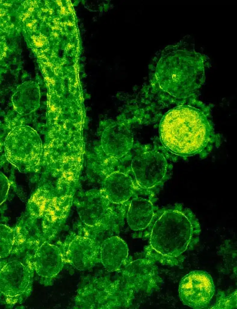 Blastomycosis